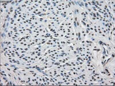 Immunohistochemistry: FKBP51/FKBP5 Antibody (OTI3E9) - Azide and BSA Free [NBP2-70742]