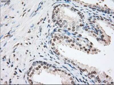 Immunohistochemistry: FKBP51/FKBP5 Antibody (OTI3E9) - Azide and BSA Free [NBP2-70742]