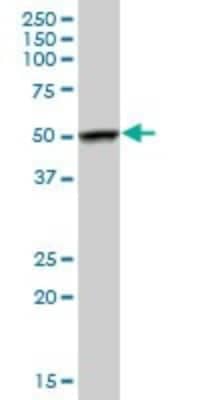 Western Blot: FKBP51/FKBP5 Antibody [H00002289-B01P]