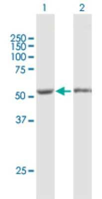 Western Blot: FKBP51/FKBP5 Antibody [H00002289-B01P]
