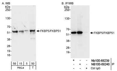 Western Blot: FKBP51/FKBP5 Antibody [NB100-68240]