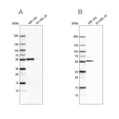 Western Blot: FKBP51/FKBP5 Antibody [NBP1-84676]