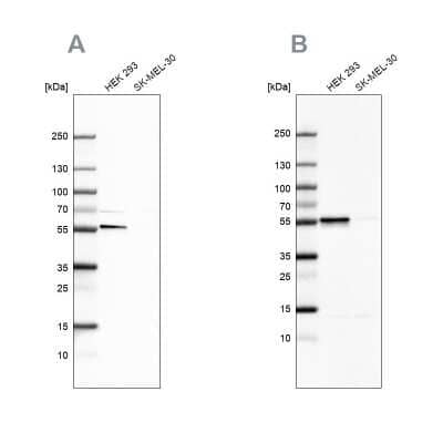 Western Blot: FKBP51/FKBP5 Antibody [NBP1-84677]