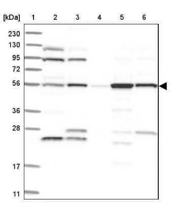 Western Blot: FKBP51/FKBP5 Antibody [NBP2-33944]