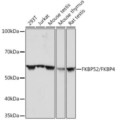 Western Blot: FKBP52/FKBP4 Antibody (3Q6H2) [NBP3-16387]