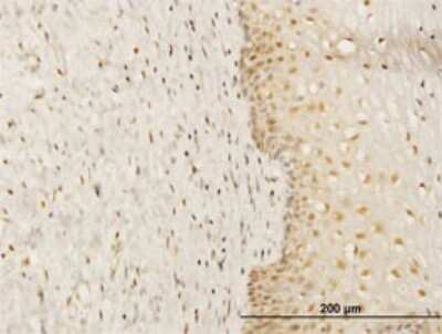 Immunohistochemistry-Paraffin: FKBP52/FKBP4 Antibody (5C11) [H00002288-M01]