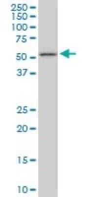 Western Blot: FKBP52/FKBP4 Antibody (5C11) [H00002288-M01]