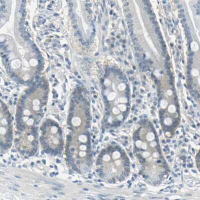 Immunohistochemistry-Paraffin: FKBP52/FKBP4 Antibody [NBP1-84675]