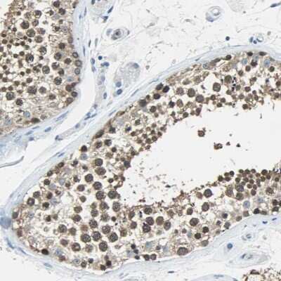 Immunohistochemistry-Paraffin: FKBP52/FKBP4 Antibody [NBP1-84675]