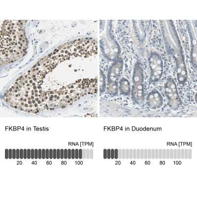 Immunohistochemistry-Paraffin: FKBP52/FKBP4 Antibody [NBP1-84675]