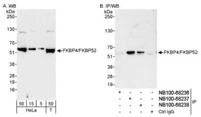 Western Blot: FKBP52/FKBP4 Antibody [NB100-68237]