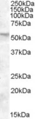 Western Blot: FKBP52/FKBP4 Antibody [NBP1-18845]