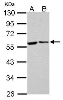 Western Blot: FKBP52/FKBP4 Antibody [NBP1-33702]