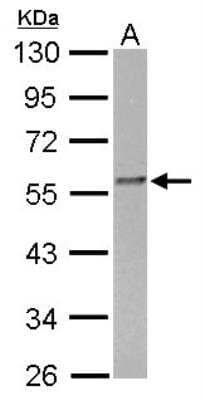 Western Blot: FKBP52/FKBP4 Antibody [NBP1-33702]