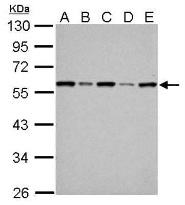 Western Blot: FKBP52/FKBP4 Antibody [NBP1-33702]