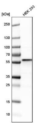 Western Blot: FKBP52/FKBP4 Antibody [NBP1-84675]