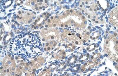 Immunohistochemistry-Paraffin: FKBP6 Antibody [NBP1-54606]