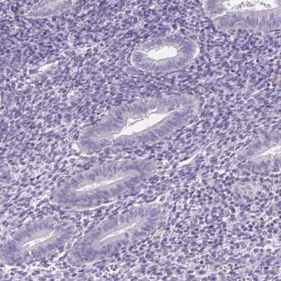 Immunohistochemistry-Paraffin: FKBP6 Antibody [NBP2-38905]