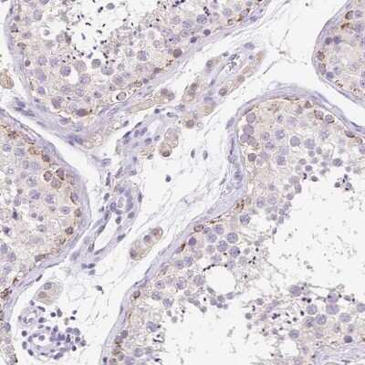 Immunohistochemistry-Paraffin: FKBP6 Antibody [NBP2-38905]