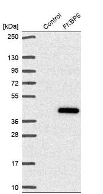 Western Blot: FKBP6 Antibody [NBP2-38905]