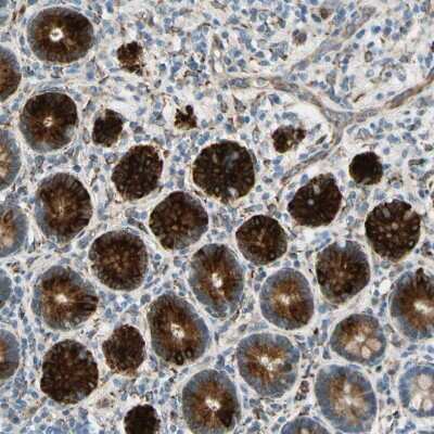 Immunohistochemistry-Paraffin: FKBP7 Antibody [NBP1-83889]