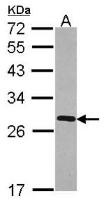 Western Blot: FKBP7 Antibody [NBP2-16499]