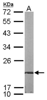 Western Blot: FKBP7 Antibody [NBP2-16499]