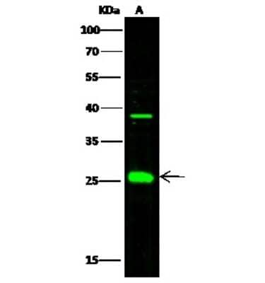 Western Blot: FKBP7 Antibody [NBP2-99915]