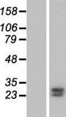 Western Blot: FKBP7 Overexpression Lysate [NBP2-04932]