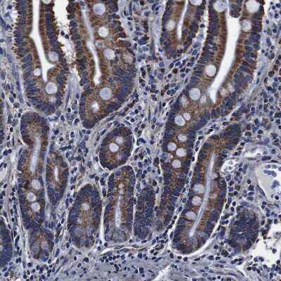 Immunohistochemistry-Paraffin: FKBP9 Antibody [NBP1-83887]