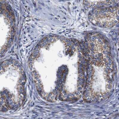 Immunohistochemistry-Paraffin: FKBP9 Antibody [NBP1-83887]