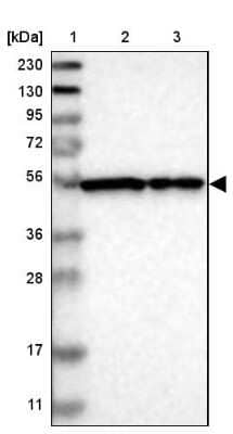 Western Blot: FKBP9 Antibody [NBP1-83887]