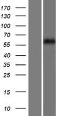 Western Blot: FKBP9 Overexpression Lysate [NBP2-07513]