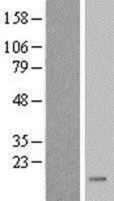 Western Blot: FKBP9L Overexpression Lysate [NBL1-10741]