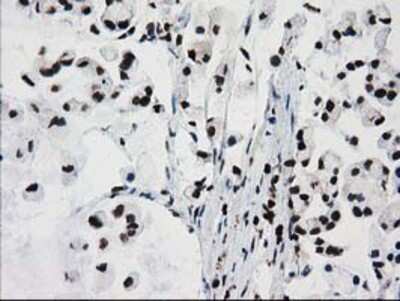 Immunohistochemistry-Paraffin: FKBPL Antibody (OTI2D8) [NBP2-03407]