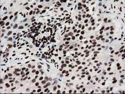 Immunohistochemistry-Paraffin: FKBPL Antibody (OTI2D8) [NBP2-03407]