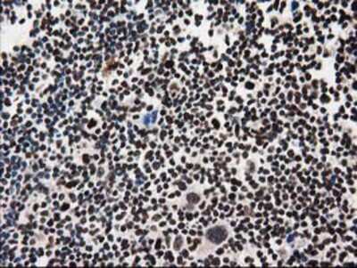 Immunohistochemistry-Paraffin: FKBPL Antibody (OTI2D8) [NBP2-03407]