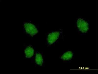 Immunocytochemistry/ Immunofluorescence: FKBPL Antibody [H00063943-B01P]
