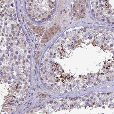 Immunohistochemistry: FKBPL Antibody [NBP2-14018]