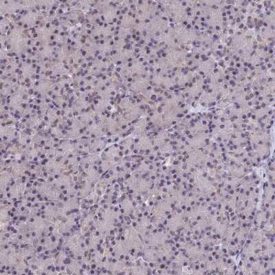 Immunohistochemistry-Paraffin: FKBPL Antibody [NBP2-14018]
