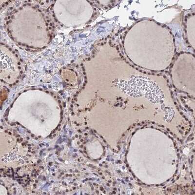 Immunohistochemistry-Paraffin: FKBPL Antibody [NBP2-14018]