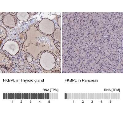 Immunohistochemistry-Paraffin: FKBPL Antibody [NBP2-14018]