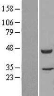 Western Blot: FKBPL Overexpression Lysate [NBL1-10742]