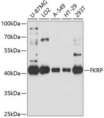 Western Blot: FKRP AntibodyAzide and BSA Free [NBP3-04945]