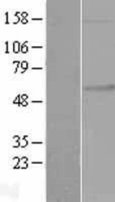 Western Blot: FKRP Overexpression Lysate [NBL1-10743]