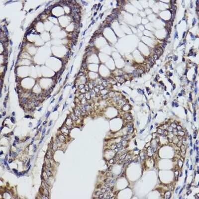 Immunohistochemistry-Paraffin: FKTN Antibody (7J5N6) [NBP3-15472]