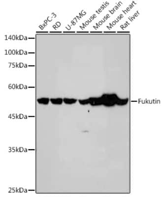 Western Blot: FKTN Antibody (7J5N6) [NBP3-15472]