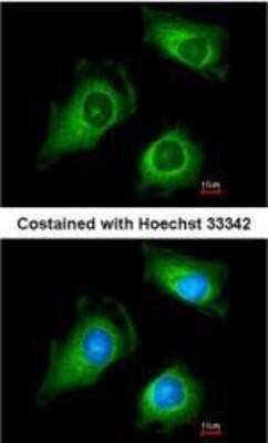 Immunocytochemistry/ Immunofluorescence: FKTN Antibody [NBP1-33383]