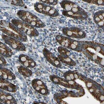 Immunohistochemistry-Paraffin: FKTN Antibody [NBP1-84707]