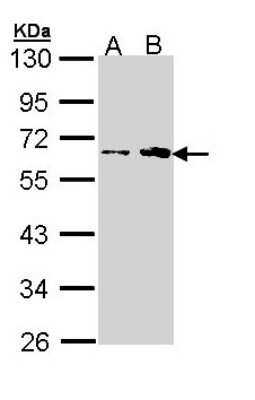 Western Blot: FKTN Antibody [NBP1-33383]